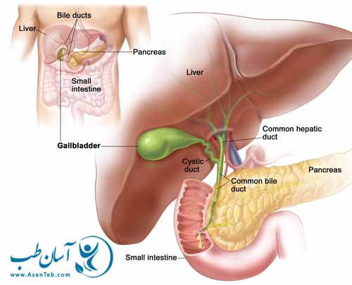 علایم سنگ کیسه صفرا