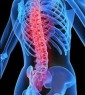 کمر درد