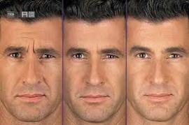 نکاتی درباره جوانسازی پوست با تزریق چربی